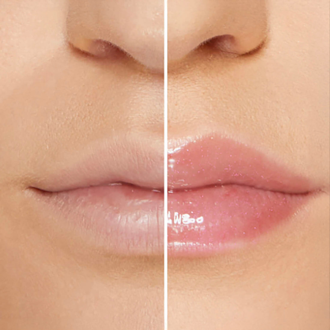 Lip Plumping